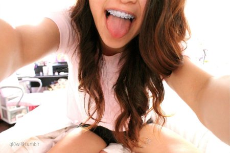 Брекеты улыбка