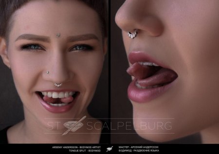 Неправильный прокол септум