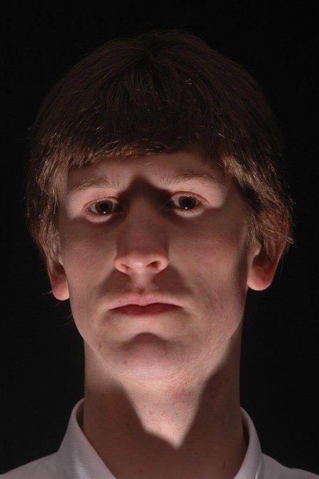 Реконструкция лица