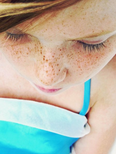 Пигментные пятна лентиго