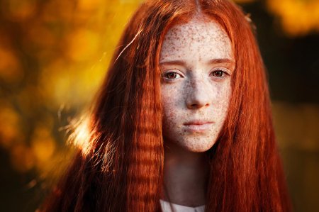 Рыжие с веснушками