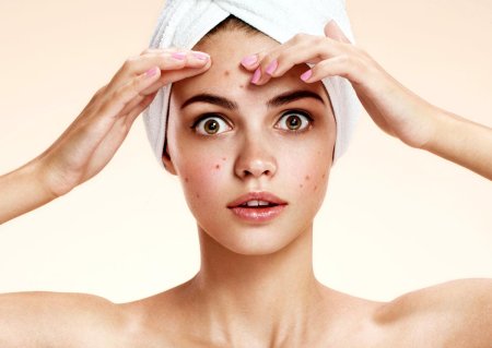 Девушка с акне