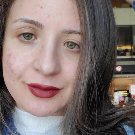 Девушка с проблемной кожей