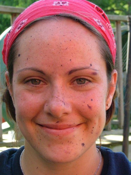 Девушка с прыщами