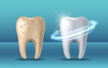 Зубная эмаль