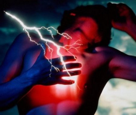 Острый инфаркт миокарда