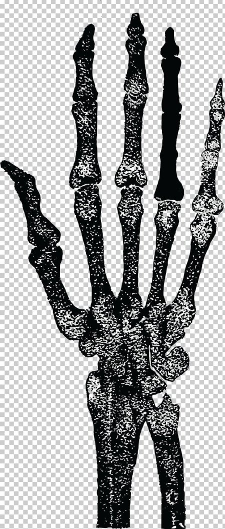 Рука скелет