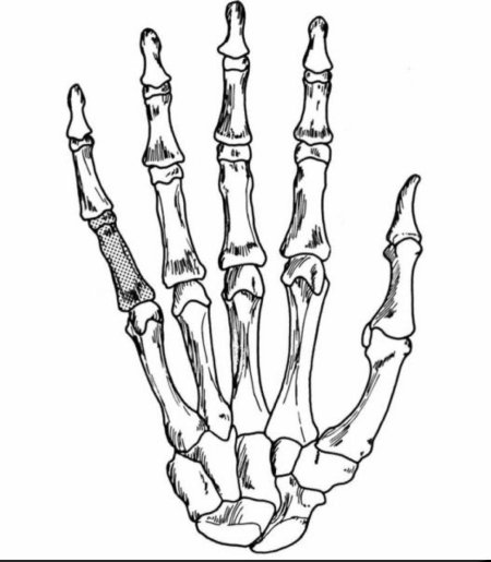 Рука скелет