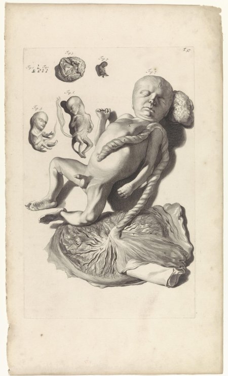 Акушерство иллюстрации