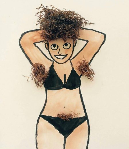 Эпиляция лазером