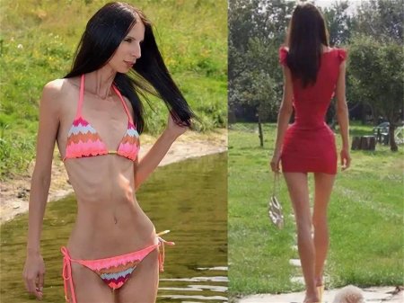 Самая худая девушка