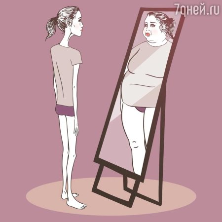 Нервная анорексия
