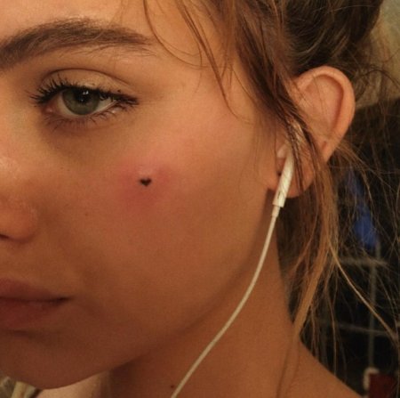 Девушки с родинками на лице