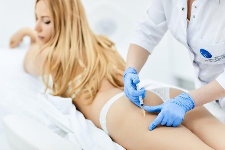 Мезотерапия тела