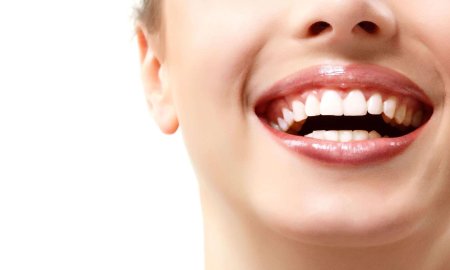 Красивые зубы