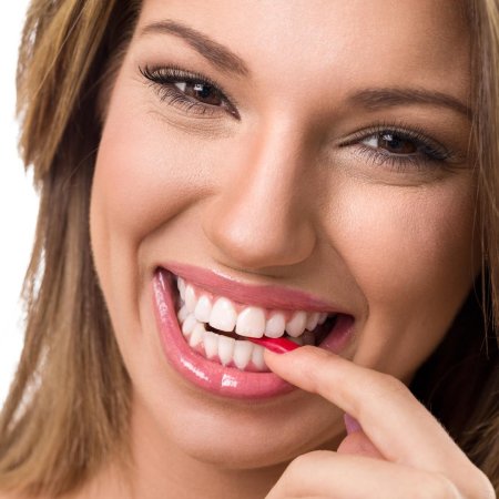Красивые зубы