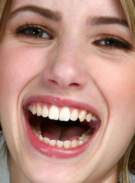 Хорошие зубы