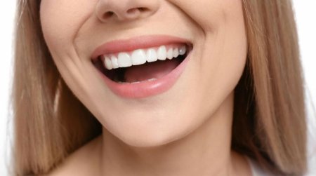 Улыбка зубами