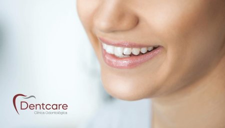 Красивые зубы