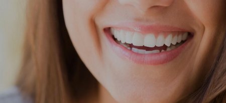 Красивые зубы