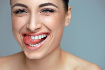 Trusmile veneers