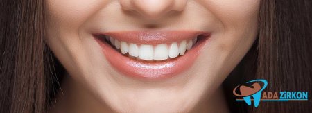 Красивые женские зубы