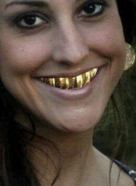 Девушка с золотыми зубами