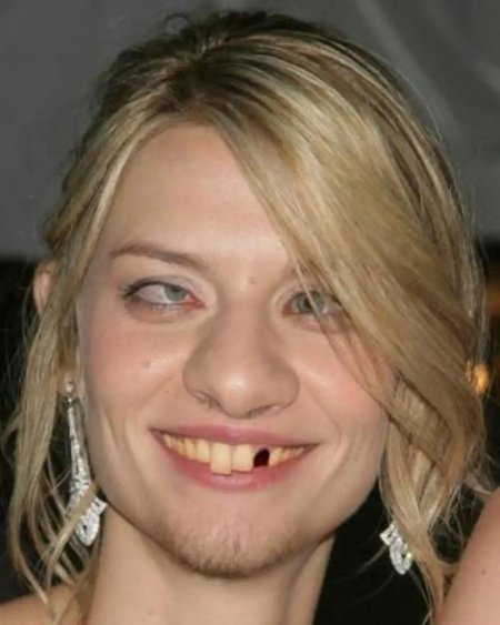 Девушка без зуба