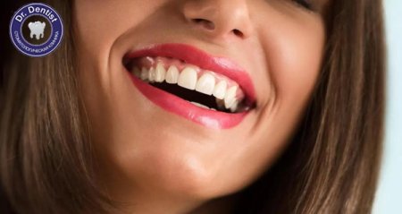 Самые красивые зубы