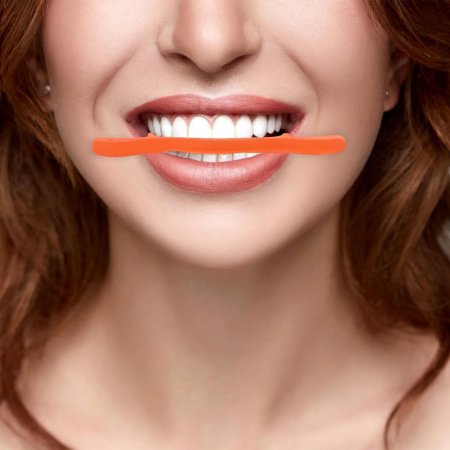 Голливудская улыбка виниры