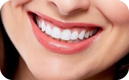 Отбеливание зубов