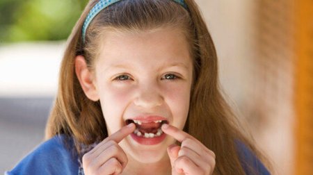 Девочка с зубами