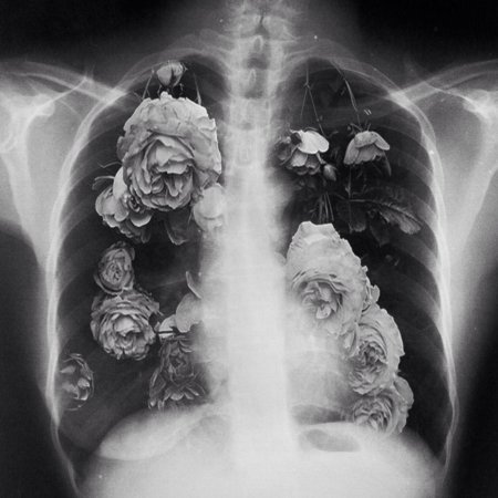 Ханахаки эстетика рентген