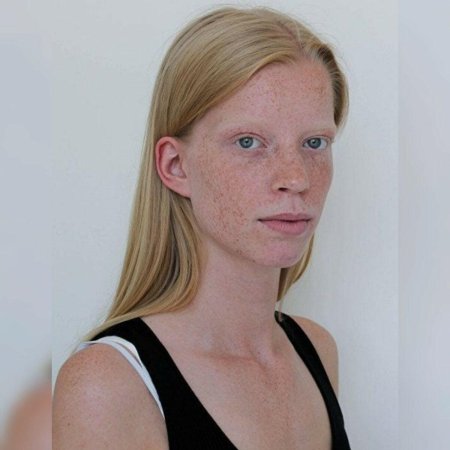 Лотте зуйдема