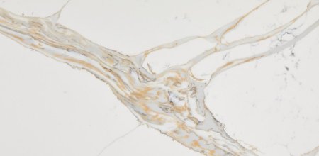 Калакатта шенонсо avant