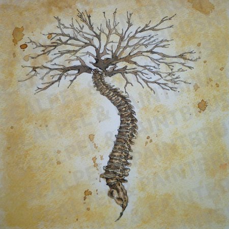 Позвоночник дерево