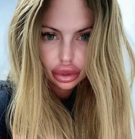 Накаченные губы