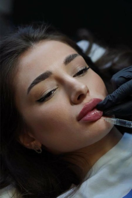 Красивая форма губ