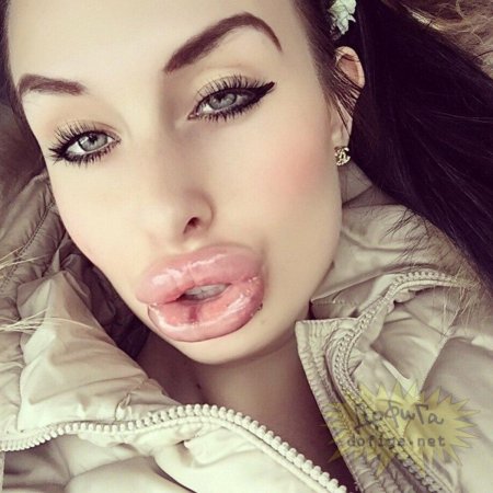 Девушка с огромными губами
