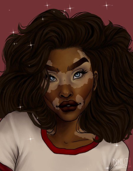 Девушка с витилиго арт