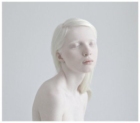 Настя жидкова альбинос