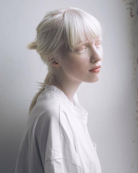 Настя жидкова альбинос