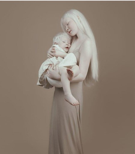 Асель калаганова альбинос