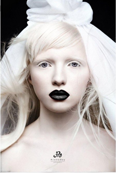 Настя жидкова альбинос