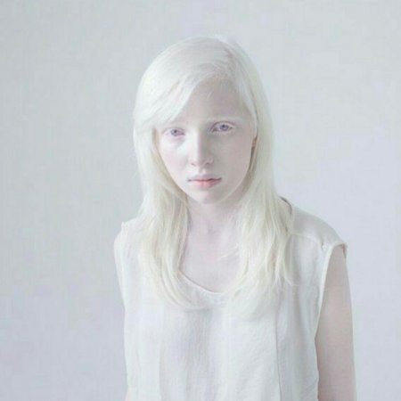 Лэйни чэнг альбинос