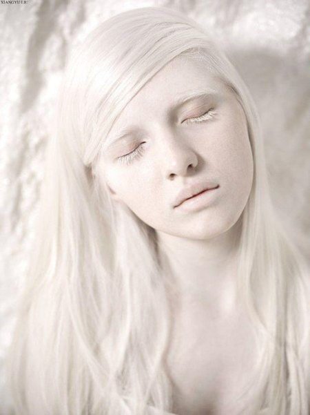 Катерина тимошенко альбинос