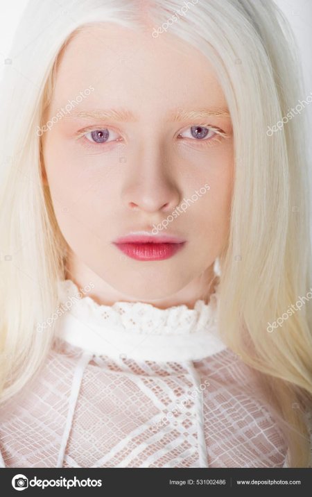 Катерина тимошенко альбинос