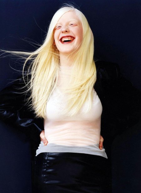 Люди альбинос