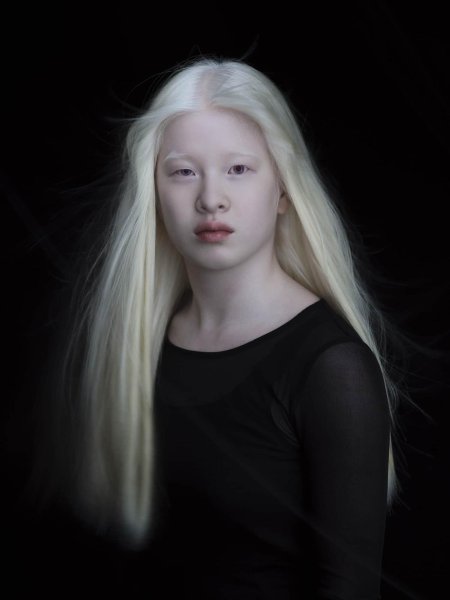 Амина эпендиева альбинос