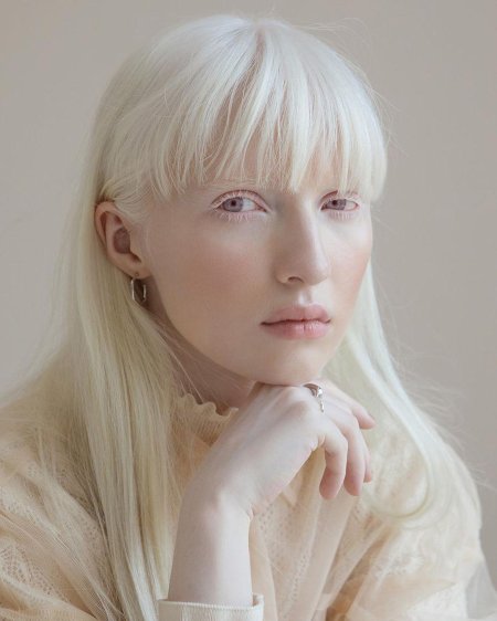 Настя жидкова альбинос